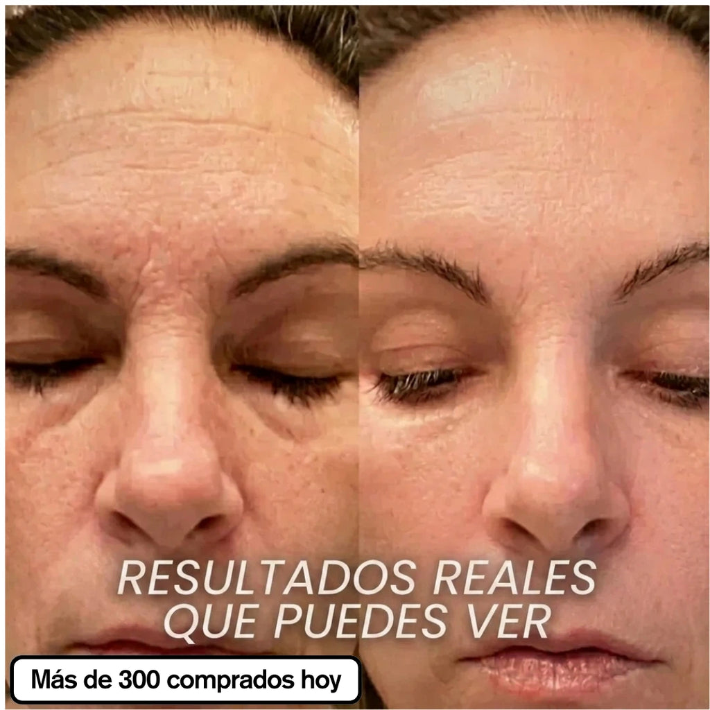 SEORI Stick Repulpante de PDRN y Biocolágeno