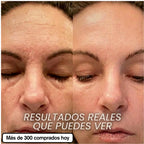 SEORI Stick Repulpante de PDRN y Biocolágeno